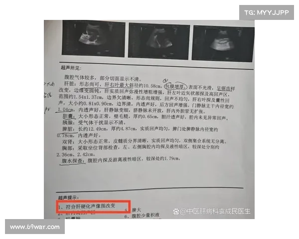 沧州传染病医院肝硬化治疗效果如何 沧州传染病医院肝硬化治疗效果如何